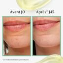 Eucerin DermoPure Sérum Triple Action 40ml anti imperfections peau grasse (3)